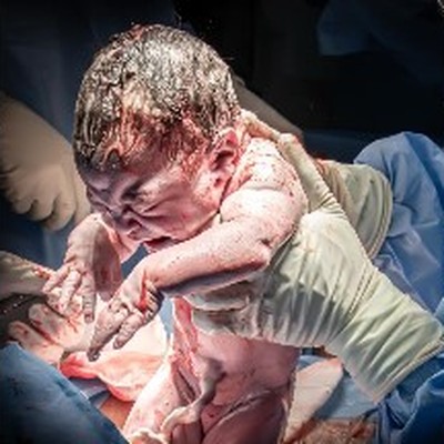 Dr. Héctor Andrés - Ginecologista Barra da Tijuca - Instagram